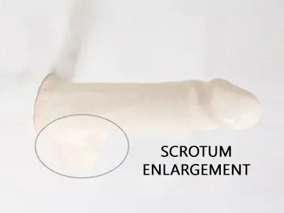Scrotal Enhancement St Petersburg FL